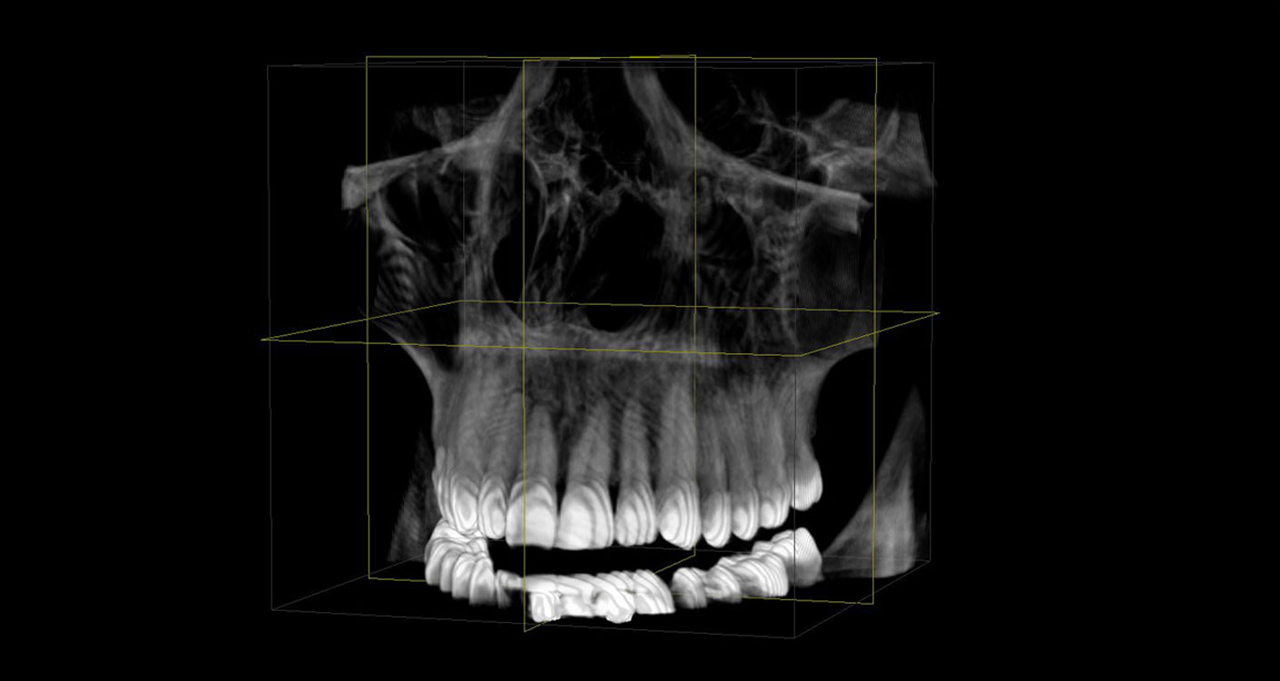 Zahnärzte Dr. Wunderer & Dr. Jung - 3D Röntgen -Digitales Volumentomographie DVT 1