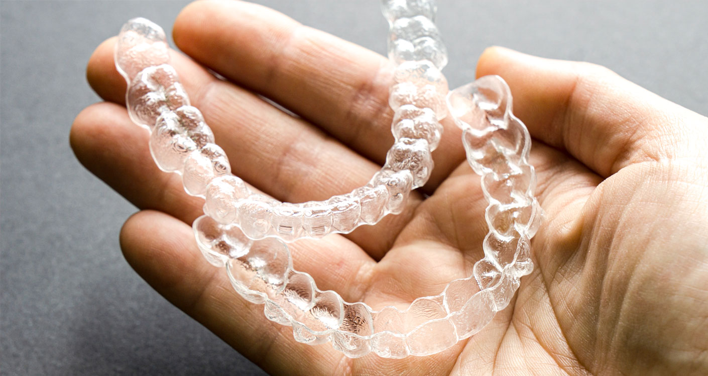 Zahnärzte Dr. Wunderer & Dr. Jung - Aligner-Therapie – durchsichtige Kunststoffschienen zur Korrektur von Zahnstellungen 2