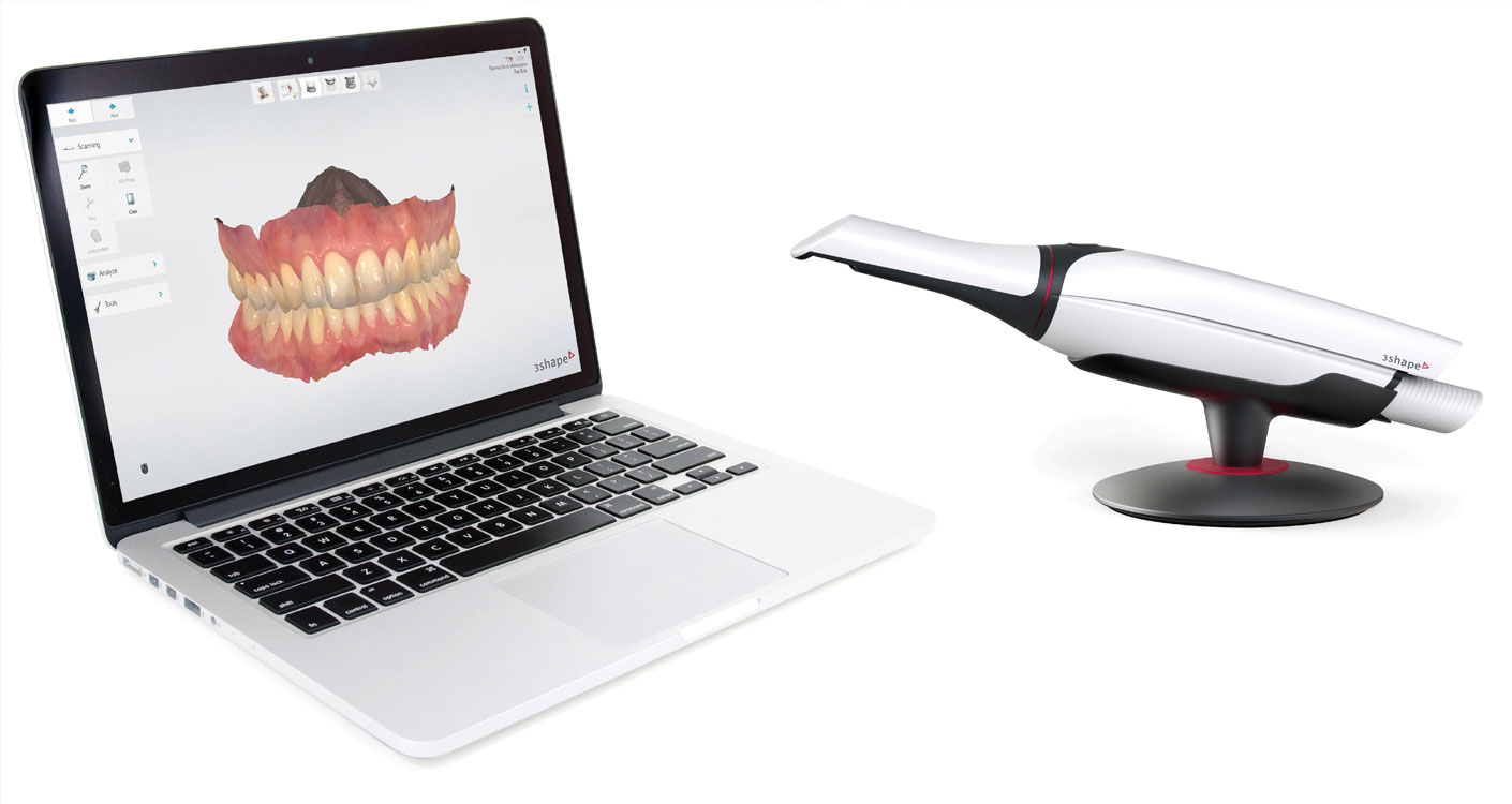 Zahnärzte Dr. Wunderer & Dr. Jung - Intraoralscanner – digitale Abformung Ihrer Zähne und Kiefer 1